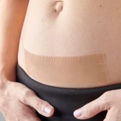 myscar The Original Caesarean Silicone Strips